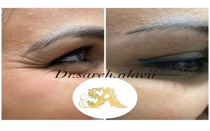 دکتر ساره  علوی  | دکتربین