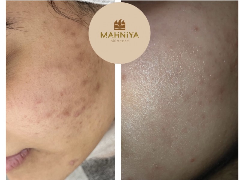 دکتر ساره  علوی  | دکتربین