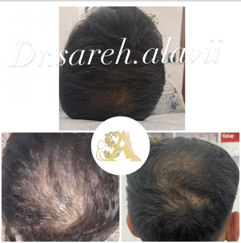 دکتر ساره  علوی  | دکتربین