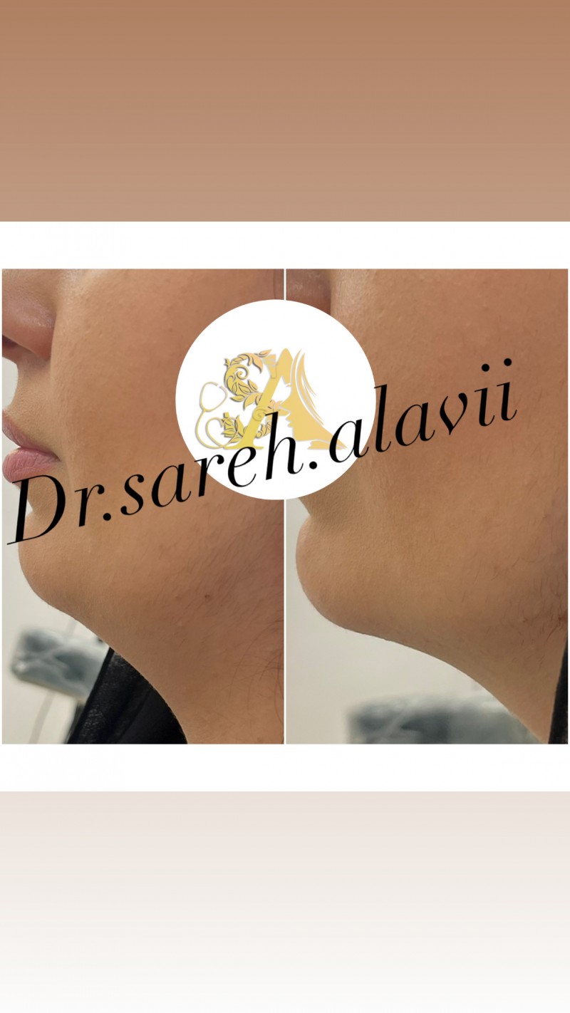 دکتر ساره  علوی  | دکتربین