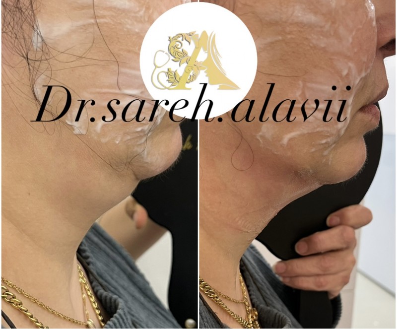 دکتر ساره  علوی  | دکتربین