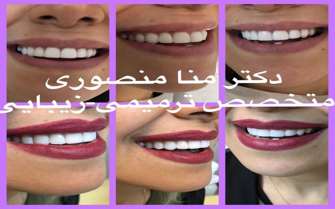 دکتر مُنا  منصوری | دکتربین