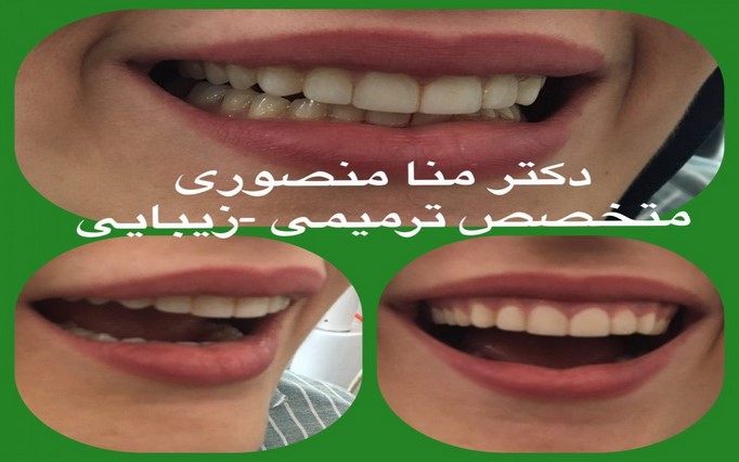 دکتر مُنا  منصوری | دکتربین