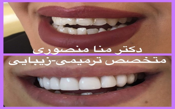 دکتر مُنا  منصوری | دکتربین