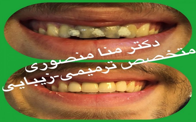 دکتر مُنا  منصوری | دکتربین