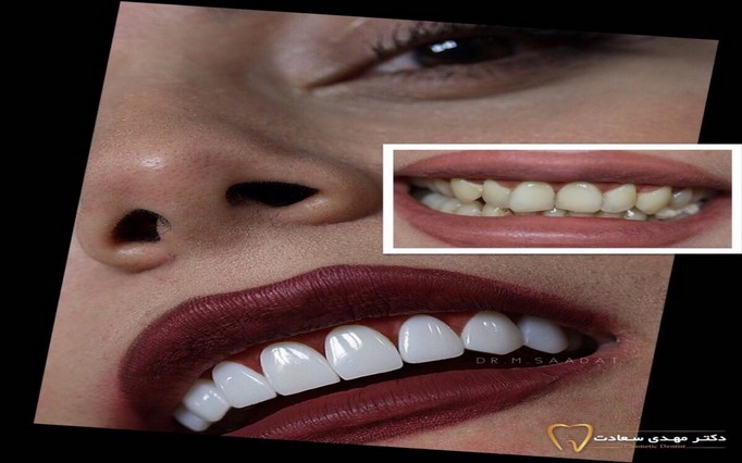 دکتر مهدی  سعادت | دکتربین