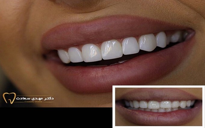 دکتر مهدی  سعادت | دکتربین