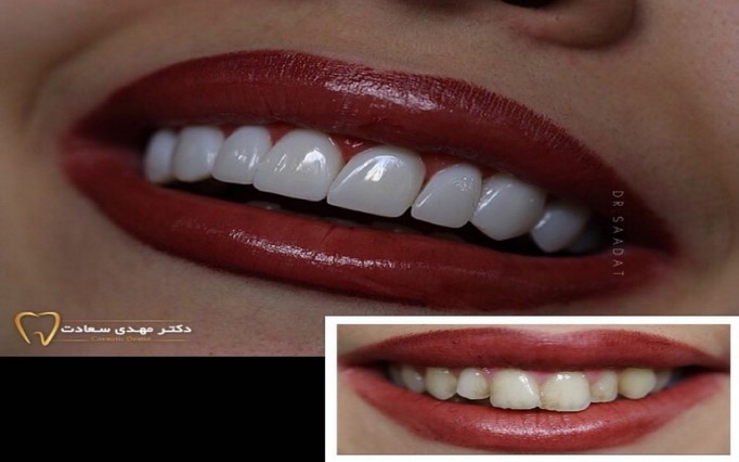 دکتر مهدی  سعادت | دکتربین