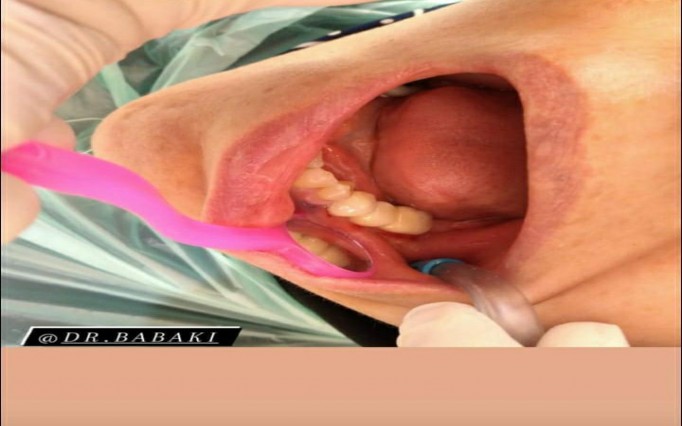 دکتر علیرضا  بابکی  | دکتربین