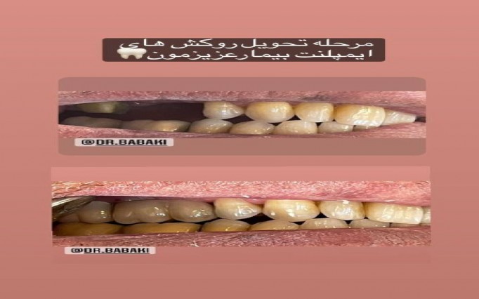 دکتر علیرضا  بابکی  | دکتربین