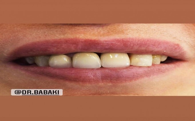 دکتر علیرضا  بابکی  | دکتربین