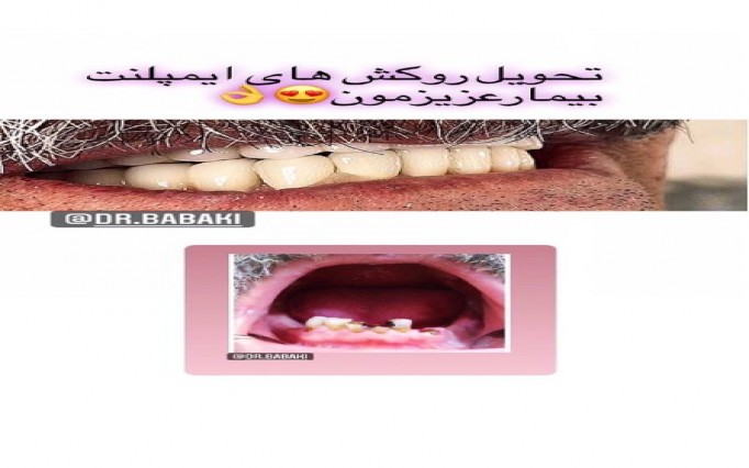 دکتر علیرضا  بابکی  | دکتربین