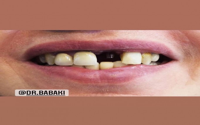 دکتر علیرضا  بابکی  | دکتربین
