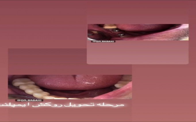 دکتر علیرضا  بابکی  | دکتربین