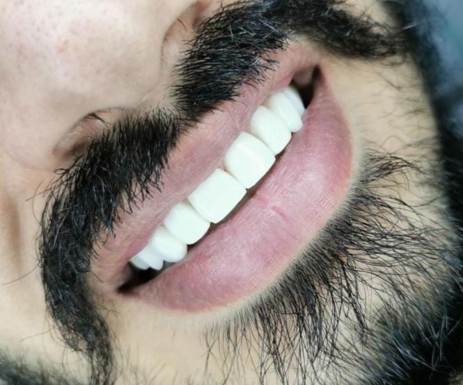 نمونه کار 